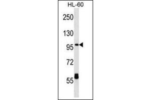 Western blot analysis of CPT1C Antibody (C-term) Cat. (CPT1C 抗体  (C-Term))