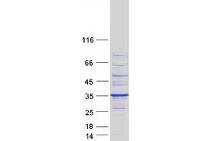 Validation with Western Blot