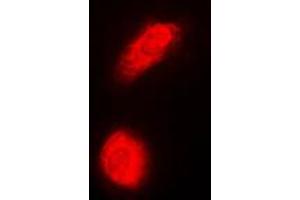 Immunofluorescent analysis of DAXX staining in HeLa cells. (DAXX 抗体  (Center))