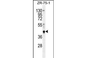 PYGO1 Antibody (C-term) (ABIN656121 and ABIN2845460) western blot analysis in ZR-75-1 cell line lysates (35 μg/lane). (PYGO1 抗体  (C-Term))