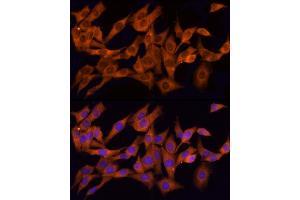 Immunofluorescence (IF) image for anti-Chloride Intracellular Channel 1 (CLIC1) (AA 42-241) antibody (ABIN6138719)