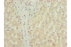 Immunohistochemistry of paraffin-embedded human liver tissue using ABIN7149150 at dilution of 1:100 (COX17 抗体  (AA 1-63))