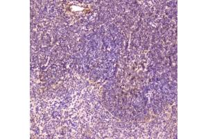 IHC testing of FFPE mouse spleen tissue with CD163 antibody at 1ug/ml. (CD163 抗体)