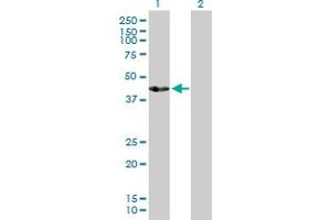 Western Blot analysis of ACTL7B expression in transfected 293T cell line by ACTL7B MaxPab polyclonal antibody. (Actl7b 抗体  (AA 1-415))