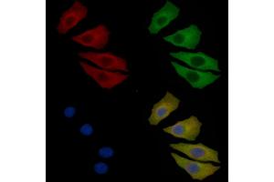 CaMKII alpha Mouse Monoclonal Antibody staining Hela cells by IF/ICC. (CAMK2A 抗体)