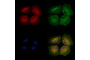 ABIN6258498 and ABIN6274470 staining  cells by IF/ICC. (ORCTL-2/SLC22A18 抗体  (C-Term))