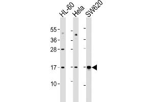 All lanes : Anti-UBE2N Antibody (Center) at 1:1000 dilution Lane 1: HL-60 whole cell lysates Lane 2: Hela whole cell lysates Lane 3: S whole cell lysates Lysates/proteins at 20 μg per lane. (UBE2N 抗体  (AA 41-74))