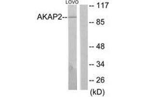 Western Blotting (WB) image for anti-A Kinase (PRKA) Anchor Protein 2 (AKAP2) (AA 71-120) antibody (ABIN2889820) (AKAP2 抗体  (AA 71-120))