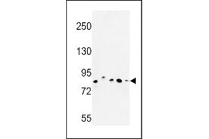 Western blot analysis of CHPF Antibody (Center) (ABIN652988 and ABIN2842628) in MDA-M, MCF-7, HepG2,  cell line and mouse testis tissue lysates (35 μg/lane). (CHPF 抗体  (AA 327-354))