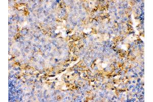 Immunohistochemistry (Paraffin-embedded Sections) (IHC (p)) image for anti-Tumor Necrosis Factor Receptor Superfamily, Member 4 (TNFRSF4) (AA 232-254), (C-Term) antibody (ABIN3044553)