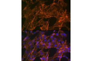 Immunofluorescence analysis of NIH-3T3 cells using α-Actinin-4 Rabbit mAb (ABIN7265399) at dilution of 1:100 (40x lens). (alpha Actinin 4 抗体)