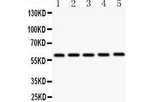 Western Blotting (WB) image for anti-Cystathionine-beta-Synthase (CBS) (AA 331-551) antibody (ABIN3043747) (CBS 抗体  (AA 331-551))