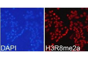 Immunofluorescence analysis of 293T cell using H3R8me2a antibody. (Histone 3 抗体  (H3R8me2a))