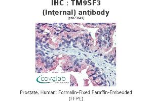 Image no. 1 for anti-Transmembrane 9 Superfamily Member 3 (TM9SF3) (Internal Region), (N-Term) antibody (ABIN1740140) (TM9SF3 抗体  (Internal Region, N-Term))