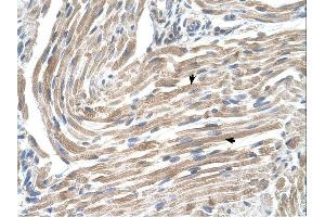 MGST2 antibody was used for immunohistochemistry at a concentration of 4-8 ug/ml. (MGST2 抗体  (N-Term))