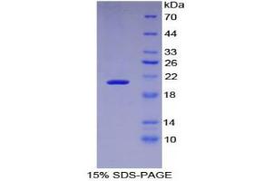 SDS-PAGE (SDS) image for Leukemia Inhibitory Factor Receptor alpha (LIFR) (AA 522-691) protein (His tag) (ABIN1980768) (LIFR Protein (AA 522-691) (His tag))