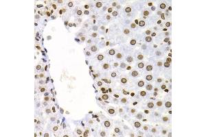 Immunohistochemistry of paraffin-embedded rat liver using NFKB2 Antibody. (NFKB2 抗体)