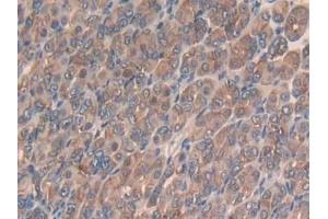 Detection of Slit3 in Mouse Stomach Tissue using Polyclonal Antibody to Slit Homolog 3 (Slit3) (SLIT3 抗体  (AA 1348-1517))