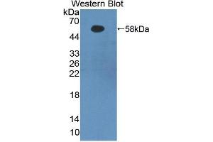 Western blot analysis of recombinant Human FGb. (Fibrinogen beta Chain 抗体  (AA 29-491))
