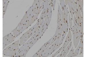 ABIN6277535 at 1/100 staining Mouse heart tissue by IHC-P. (IMPDH2 抗体  (Internal Region))