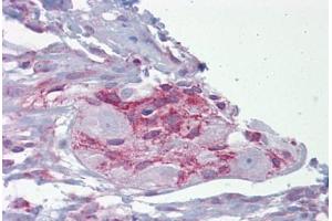 Anti-ASPH antibody IHC staining of human small intestine and myenteric plexus. (Aspartate beta Hydroxylase 抗体  (AA 107-156))