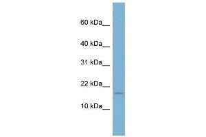 WB Suggested Anti-RPS13 Antibody Titration: 0. (RPS13 抗体  (N-Term))