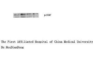 Western Blotting (WB) image for anti-Signal Transducer and Activator of Transcription 1, 91kDa (STAT1) (pTyr701) antibody (ABIN3182148)