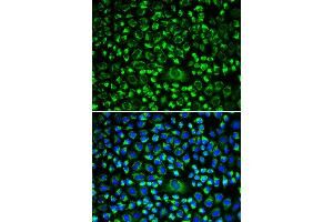 Immunofluorescence analysis of HeLa cells using TAPBP antibody. (TAPBP 抗体)