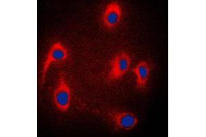 Immunofluorescent analysis of JIP3 staining in PC12 cells.