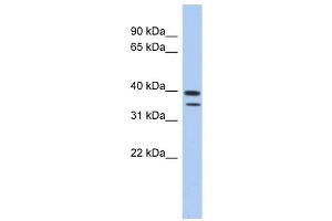 C4ORF23 antibody used at 1 ug/ml to detect target protein. (C4ORF23 抗体  (N-Term))