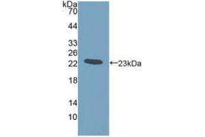 Western blot analysis of recombinant Human GREM1. (GREM1 抗体  (AA 26-184))
