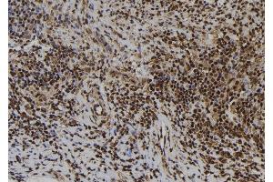 ABIN6273425 at 1/100 staining Human spleen tissue by IHC-P. (ATRAID 抗体  (Internal Region))