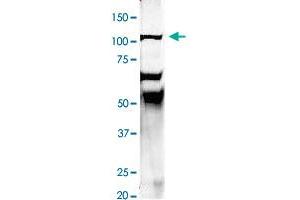 Immunoprecipitation of rat brain homogenate with EEA1 polyclonal antibody  at 1:500 dilution. (EEA1 抗体  (N-Term))