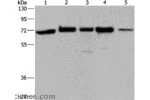 Western blot analysis of A172, Hela and 293T cell, K562 cell and human testis tissue, using AGFG1 Polyclonal Antibody at dilution of 1:727 (AGFG1 抗体)