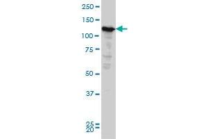 NOPE monoclonal antibody (M03), clone 6E6 Western Blot analysis of NOPE expression in HeLa . (IGDCC4 抗体  (AA 1152-1250))