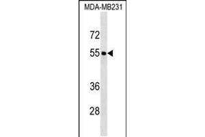 Western blot analysis in MDA-MB231 cell line lysates (35ug/lane). (FOXQ1 抗体  (AA 263-292))