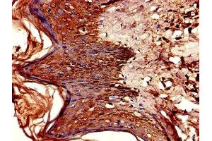 Immunohistochemistry of paraffin-embedded human skin tissue using ABIN7154406 at dilution of 1:100 (CSF2RA 抗体  (AA 23-320))