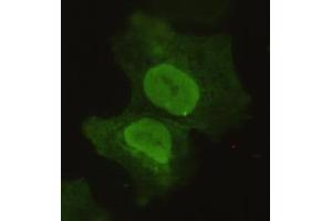 Immunocytochemistry of COS7 cells using anti-Sox2 mouse mAb diluted 1:150. (SOX2 抗体)