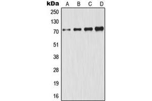 Western blot analysis of GCLC expression in HeLa (A), A431 (B), Jurkat (C), HepG2 (D) whole cell lysates.