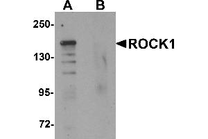 Western blot analysis of ROCK1 in 293 cell lysate with ROCK1 antibody at 1 µg/mL in (A) the absence and (B) the presence of blocking peptide. (ROCK1 抗体  (N-Term))