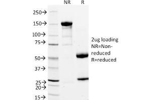 SDS-PAGE Analysis Purified StAR Mouse Monoclonal Antibody (STAR/2154). (STAR 抗体  (AA 39-108))