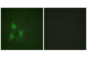 Immunofluorescence (IF) image for anti-PKA alpha/beta Cat (pThr197) antibody (ABIN1847296) (PKA alpha/beta Cat (pThr197) 抗体)
