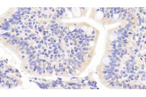 Immunohistochemistry (IHC) image for anti-Mitogen-Activated Protein Kinase 8 (MAPK8) (AA 145-419) antibody (ABIN7439321)