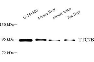 Western blot analysis of TTC7B (ABIN7075876) at dilution of 1: 500 (TTC7B 抗体)