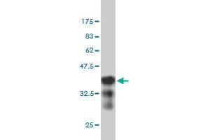Western Blot detection against Immunogen (36. (NCAPH 抗体  (AA 645-741))