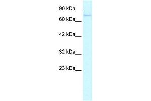 Human HepG2; WB Suggested Anti-ZNF336 Antibody Titration: 0. (ZNF336 抗体  (N-Term))