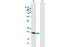 Western Blot analysis of HBXIP expression in transfected 293T cell line by HBXIP MaxPab polyclonal antibody. (HBXIP 抗体  (AA 1-173))