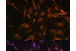 Immunofluorescence (IF) image for anti-Proteasome (Prosome, Macropain) 26S Subunit, Non-ATPase, 13 (PSMD13) antibody (ABIN7011467)