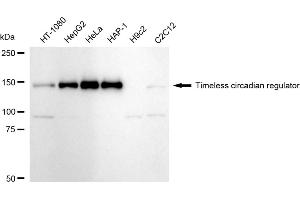 Western blotting analysis using Timeless circadian regulator antibody (ABIN7800558). (Recombinant TIMELESS 抗体)