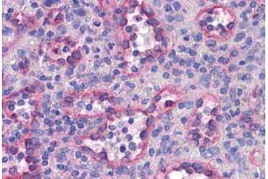 Immunohistochemistry (Formalin-fixed Paraffin-embedded Sections) (IHC (fp)) image for anti-Sterol Regulatory Element Binding Transcription Factor 2 (SREBF2) (AA 304-353) antibody (ABIN6745766)